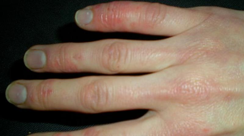 The research was supported by the National Institutes of Health. (Photo: ANI) The research was supported by the National Institutes of Health. (Photo: ANI)