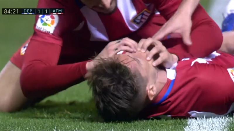 Atletico's Sime Vrsaljko and captain Gabi have also been praised for reacting quickly to ensure Fernando Torres didn't swallow his tongue whilst unconscious. (Photo: Screengrab) Atletico's Sime Vrsaljko and captain Gabi have also been praised for reacting quickly to ensure Fernando Torres didn't swallow his tongue whilst unconscious. (Photo: Screengrab)
