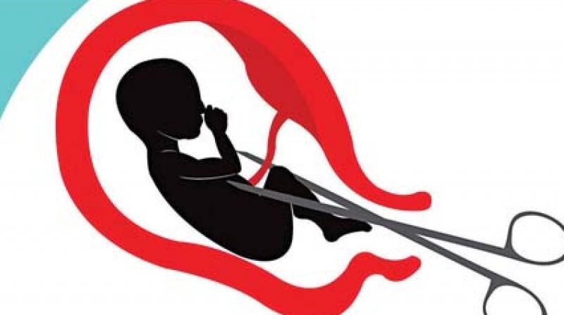 A mere 22% of more than 15 billion abortions conducted annually are within adequate health facilities accounting to almost 10 deaths per day A mere 22% of more than 15 billion abortions conducted annually are within adequate health facilities accounting to almost 10 deaths per day