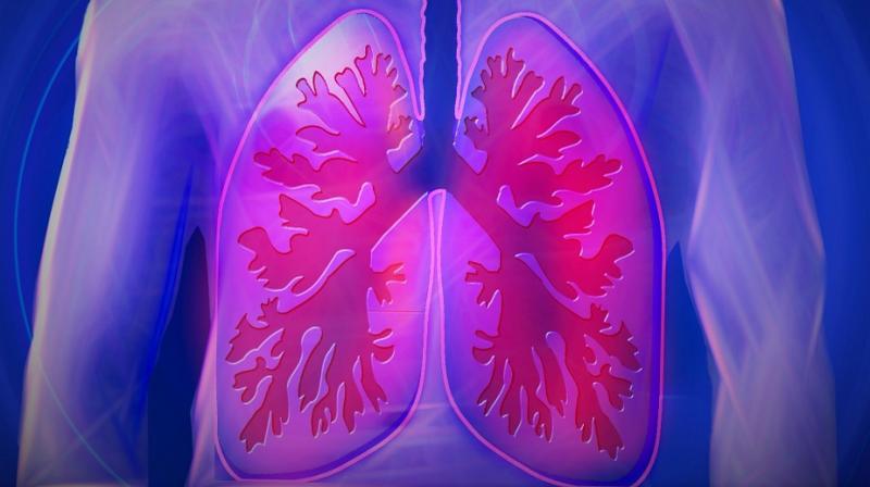 OPD is a group of diseases that hamper airflow to the lungs and cause serious long-term disability and early death. (Photo: Representational/Pixabay) OPD is a group of diseases that hamper airflow to the lungs and cause serious long-term disability and early death. (Photo: Representational/Pixabay)