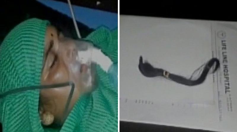 Earlier on August 4, three more cases of braid chopping were reported from Begumpur and Prashant Vihar areas in New Delhi. (Photo: ANI) Earlier on August 4, three more cases of braid chopping were reported from Begumpur and Prashant Vihar areas in New Delhi. (Photo: ANI)