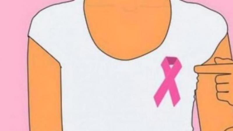 Radiation therapy could reduce risk of breast cancer recurrence. (Photo: Pixabay) Radiation therapy could reduce risk of breast cancer recurrence. (Photo: Pixabay)