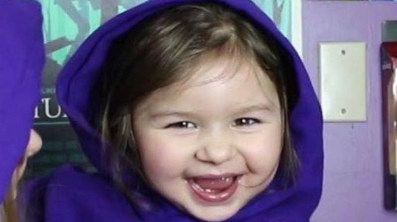 The toddler has a rare condition called Angelman Syndrome that doesn't have a cure. (Photo: Facebook/KirkHisko) The toddler has a rare condition called Angelman Syndrome that doesn't have a cure. (Photo: Facebook/KirkHisko)