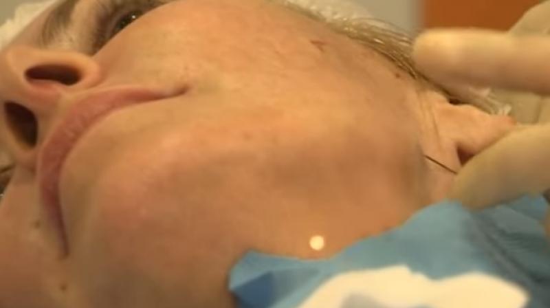 It has been referred to as the lunchtime facelift because of instant results (Photo: YouTube) It has been referred to as the lunchtime facelift because of instant results (Photo: YouTube)