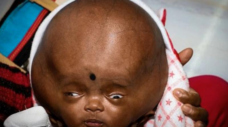 Meanwhile his helpless parents have lost hope already as they feel their child will die despite the efforts (Photo: YouTube) Meanwhile his helpless parents have lost hope already as they feel their child will die despite the efforts (Photo: YouTube)