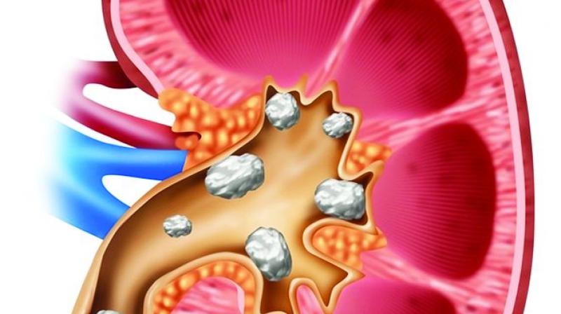The research was presented at the European Association of Urology Conference in Copenhagen. The research was presented at the European Association of Urology Conference in Copenhagen.