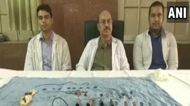 Team of doctors who operated on the man. (Photo: ANI) Team of doctors who operated on the man. (Photo: ANI)