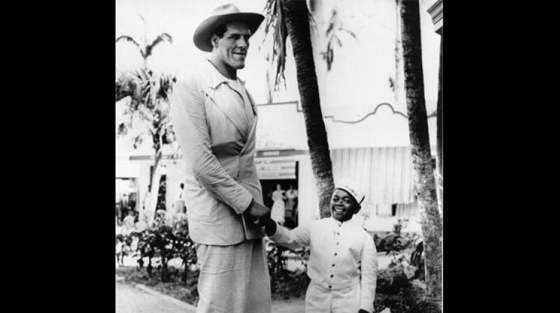 Taller individuals have longer leg veins there is more surface area where problems can occur. (Photo: AP) Taller individuals have longer leg veins there is more surface area where problems can occur. (Photo: AP)