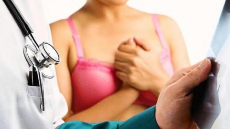 Breast cancer on the rise in India. (Photo: AFP) Breast cancer on the rise in India. (Photo: AFP)