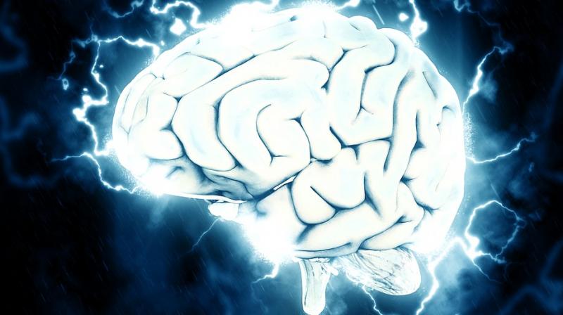 Researchers hope to use the artificially created structures to test treatment methods for dementia and speed up drug development (Photo: Pixabay) Researchers hope to use the artificially created structures to test treatment methods for dementia and speed up drug development (Photo: Pixabay)