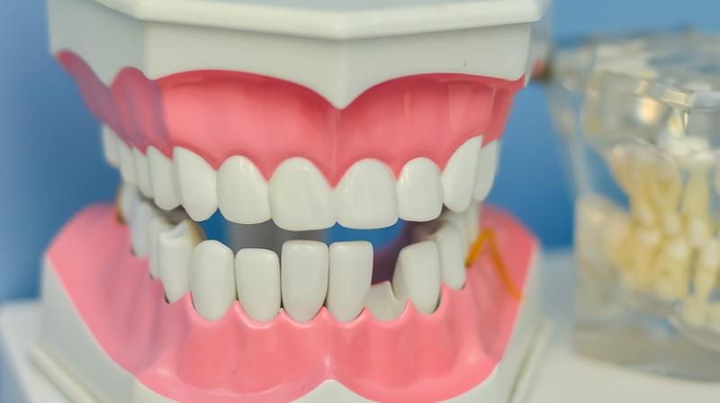 Chronic gum inflammation, known as periodontitis, is associated with an increased risk of developing Alzheimer's disease (Photo: Pixabay) Chronic gum inflammation, known as periodontitis, is associated with an increased risk of developing Alzheimer's disease (Photo: Pixabay)