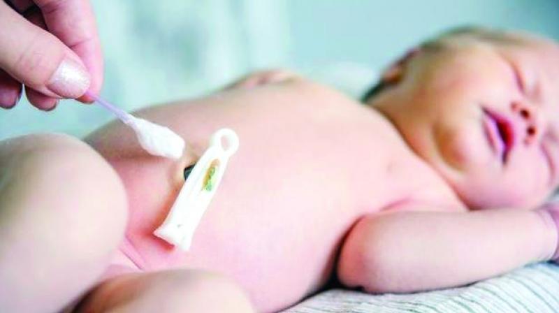 Researchers describe the stem cell procedure in an infant with cleft lip and palate, diagnosed by ultrasound before birth. Researchers describe the stem cell procedure in an infant with cleft lip and palate, diagnosed by ultrasound before birth.