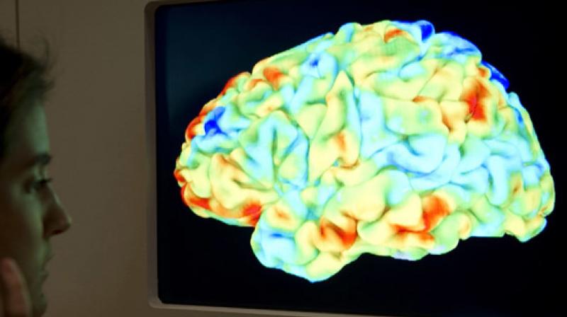 The reduced brain volume linked to non-alcoholic fatty liver disease (NAFLD) is equivalent to an extra 4.2 years of aging for people in their 60s and early 70s. (Photo: AFP) The reduced brain volume linked to non-alcoholic fatty liver disease (NAFLD) is equivalent to an extra 4.2 years of aging for people in their 60s and early 70s. (Photo: AFP)