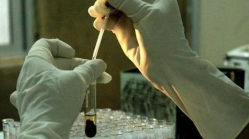 The iPSCs are grown in the laboratory and then coaxed into becoming RPE for surgical implantation. The iPSCs are grown in the laboratory and then coaxed into becoming RPE for surgical implantation.