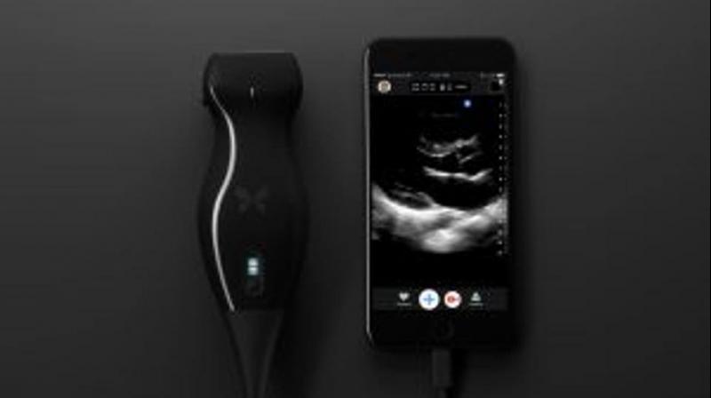 Scientists have developed a novel smartphone-based portable ultrasound machine that can help detect cancer easily at home. (Photo: Facebook/ButterflyNetworkInc.) Scientists have developed a novel smartphone-based portable ultrasound machine that can help detect cancer easily at home. (Photo: Facebook/ButterflyNetworkInc.)