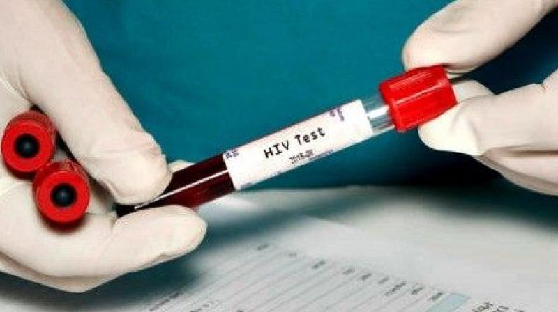 Area councillor in Uttar Pradesh's Unnao said if proper tests are done at least 500 cases of HIV would come
