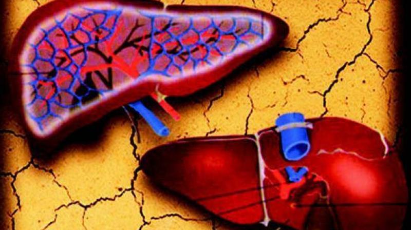(Representational Image) (Representational Image)