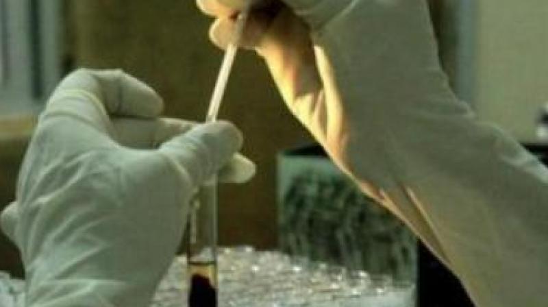 The intelligence squads would track down the source of adulteration and give tip-off (Representational Images). The intelligence squads would track down the source of adulteration and give tip-off (Representational Images).