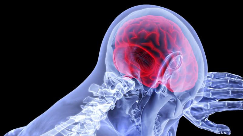 Cell therapy could improve brain function for Alzheimer's disease. (Photo: Pixabay) Cell therapy could improve brain function for Alzheimer's disease. (Photo: Pixabay)
