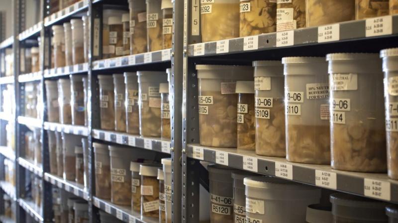 Inflammation is a normal part of the body’s response to illness and injury, one method of fighting infection or healing wounds. (Photo: AP) Inflammation is a normal part of the body’s response to illness and injury, one method of fighting infection or healing wounds. (Photo: AP)