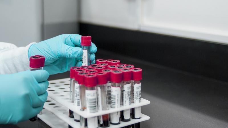 'Reprogrammed' stem cells could fight Parkinson's disease. (Photo: Pixabay) 'Reprogrammed' stem cells could fight Parkinson's disease. (Photo: Pixabay)