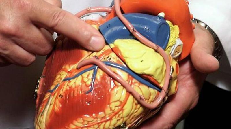 Obesity is associated with a high risk of developing cardiovascular disease. (Photo: AP) Obesity is associated with a high risk of developing cardiovascular disease. (Photo: AP)