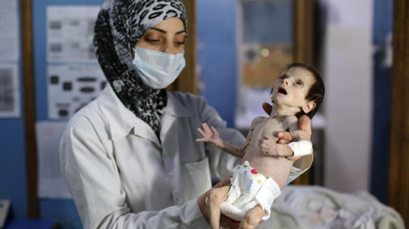 Like hundreds of children in Ghouta, Sahar was suffering from acute malnutrition (Photo: AFP) Like hundreds of children in Ghouta, Sahar was suffering from acute malnutrition (Photo: AFP)