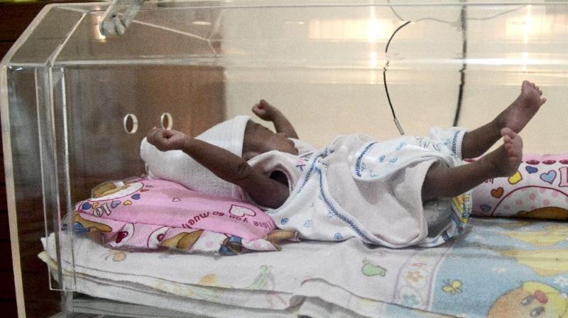 Indonesia has the fifth greatest number of premature births of any nation in the world, at 675,700 a year, according to the World Health Organization. (Photo: AFP) Indonesia has the fifth greatest number of premature births of any nation in the world, at 675,700 a year, according to the World Health Organization. (Photo: AFP)