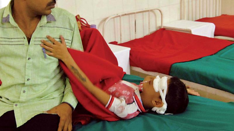 A boy undergoing treatment for cracker injuries at Minto Eye hospital in Bengaluru on Thursday. (Photo: KPN) A boy undergoing treatment for cracker injuries at Minto Eye hospital in Bengaluru on Thursday. (Photo: KPN)