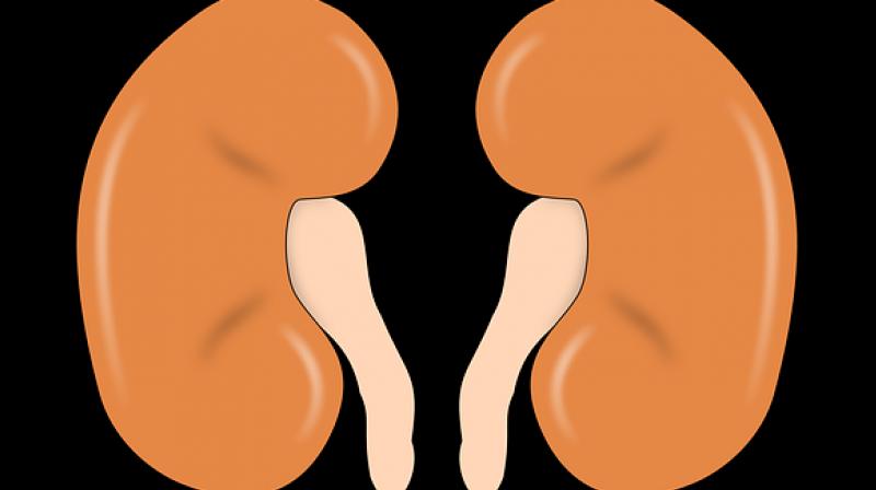 The mini-kidneys lack a large artery, and without that the organ's function will only be a fraction of normal. (Photo: Pixabay) The mini-kidneys lack a large artery, and without that the organ's function will only be a fraction of normal. (Photo: Pixabay)