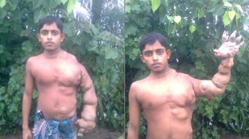 He has to keep his hand on his head to maintain balance (Photo: Facebook) He has to keep his hand on his head to maintain balance (Photo: Facebook)