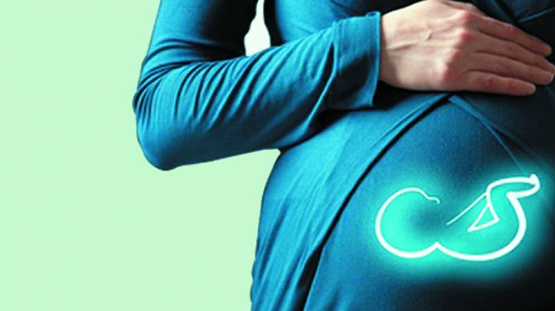 Oncosurgeon Dr Shailesh Puntambekar, who performed the surgery with a team of doctors said the operation was successful. Oncosurgeon Dr Shailesh Puntambekar, who performed the surgery with a team of doctors said the operation was successful.