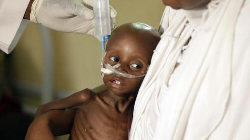 A doctor feeds a malnourished child at a feeding centre run by Doctors Without Borders in Maiduguri, Nigeria. (Photo: AP) A doctor feeds a malnourished child at a feeding centre run by Doctors Without Borders in Maiduguri, Nigeria. (Photo: AP)