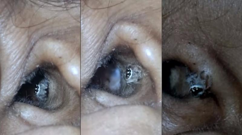 The spider casually crawled out when exposed to light (Photo: YouTube) The spider casually crawled out when exposed to light (Photo: YouTube)