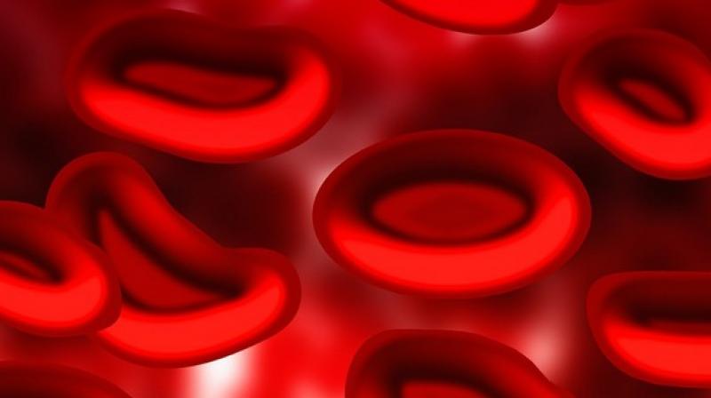 Generally, the familial risk was more pronounced when relatives were diagnosed at younger ages. (Photo: ANI) Generally, the familial risk was more pronounced when relatives were diagnosed at younger ages. (Photo: ANI)