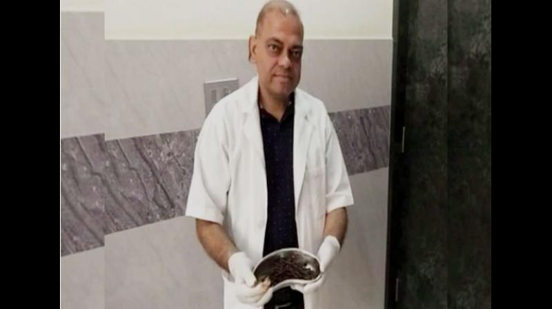 'The patient is a bit mentally unstable and does not respond to our questions. He did not tell how so many nails entered his stomach. He is doing fine now,' he said. (Photo: ANI) 'The patient is a bit mentally unstable and does not respond to our questions. He did not tell how so many nails entered his stomach. He is doing fine now,' he said. (Photo: ANI)