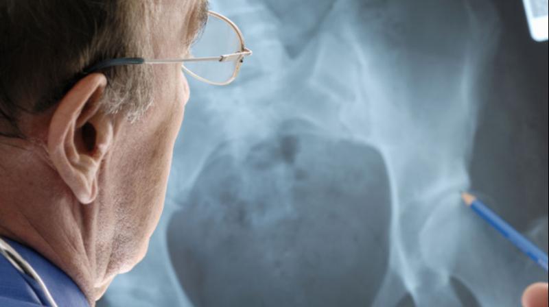 The research paves the way for treatments to preserve long-term skeletal health (Photo: AFP) The research paves the way for treatments to preserve long-term skeletal health (Photo: AFP)