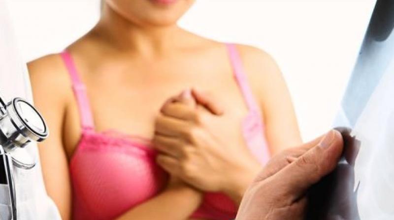 It gives shapelier breasts and less wrinkles (Photo: AFP) It gives shapelier breasts and less wrinkles (Photo: AFP)