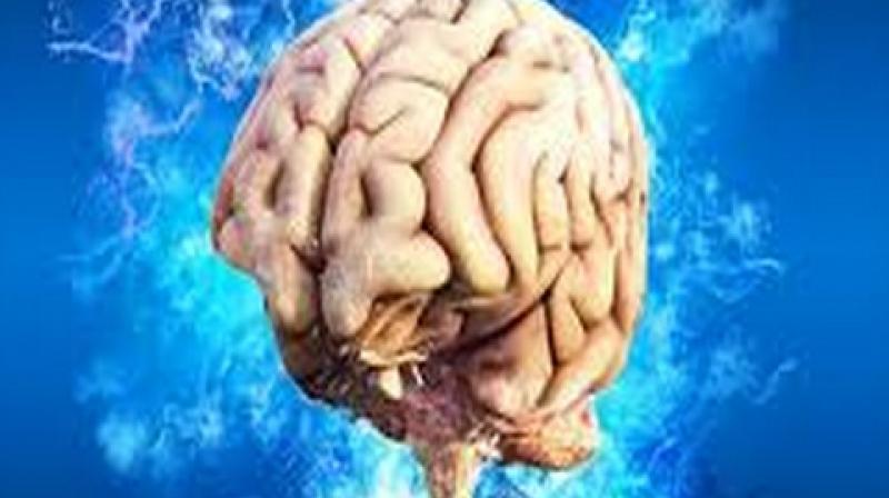 The brain consists of around one hundred billion neurons. The brain consists of around one hundred billion neurons.