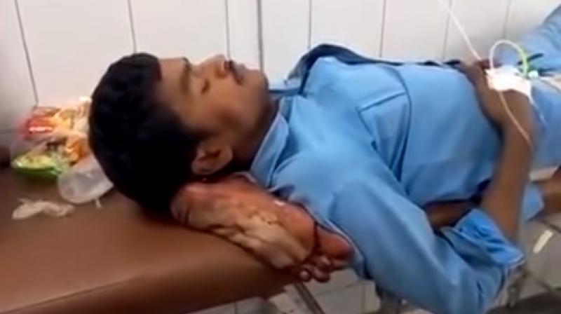 India suspends doctors, launches probe after patient's severed leg used as pillow India suspends doctors, launches probe after patient's severed leg used as pillow