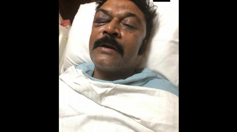 Sources at the private hospital where Anand Singh had been admitted had said Sunday he has 'a black eye and suffered blunt injuries.' (Photo: ANI) Sources at the private hospital where Anand Singh had been admitted had said Sunday he has 'a black eye and suffered blunt injuries.' (Photo: ANI)