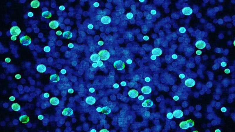 Microbes could help predict pace of climate change. (Photo: Pixabay) Microbes could help predict pace of climate change. (Photo: Pixabay)