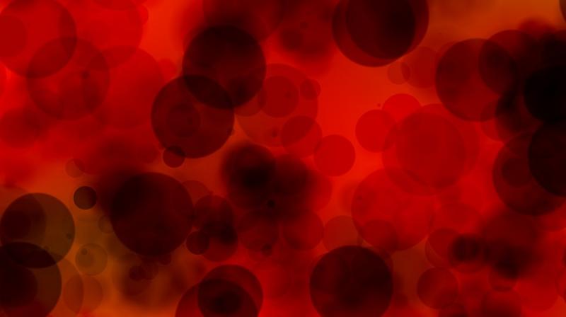 New study claims low protein diet could help cure cancer. (Photo: Pixabay) New study claims low protein diet could help cure cancer. (Photo: Pixabay)