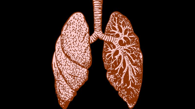 Interstitial Lung Disease (ILD) broadly describes a diverse collection of more than 200 lung disorders while tomography is a method of producing a three-dimensional image of the internal structures of a solid object such as the human body. Interstitial Lung Disease (ILD) broadly describes a diverse collection of more than 200 lung disorders while tomography is a method of producing a three-dimensional image of the internal structures of a solid object such as the human body.