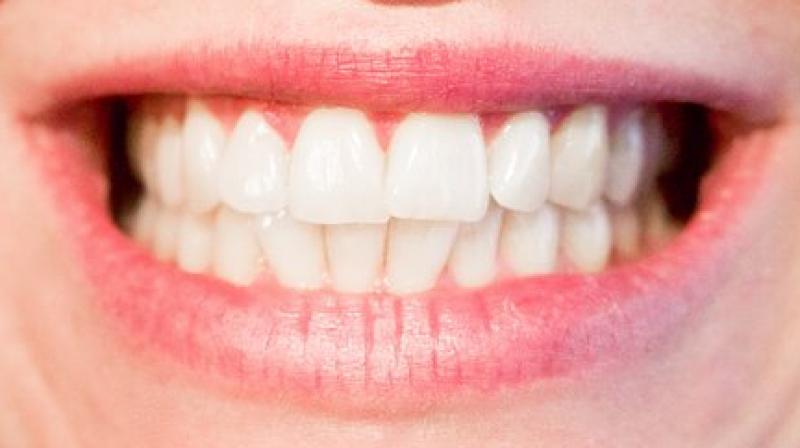 The findings suggest a deep evolutionary relationship between these primitive fish scales and the teeth of vertebrates. (Photo: Pixabay) The findings suggest a deep evolutionary relationship between these primitive fish scales and the teeth of vertebrates. (Photo: Pixabay)