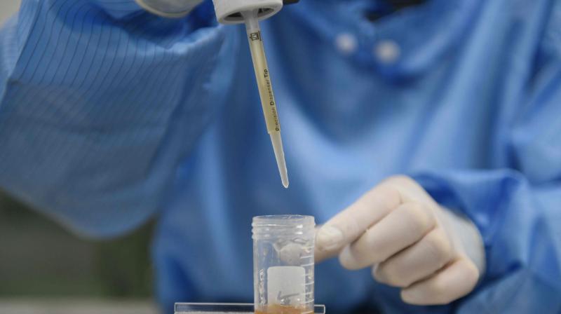 A technician makes a medical test kits in a lab at Sophonix, a company which produces test kits for medical use, in Beijing. The company is awaiting regulatory approval for a COVID-19 coronavirus antibody test kit that came out in February. AFP