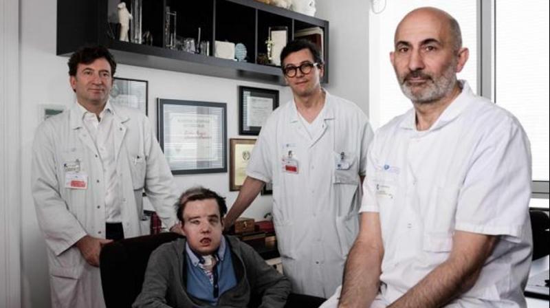 French medicine professor Laurent Lantieri (right), a specialist in hand and face transplant, poses with members of his team and his patient Jerome Hamon on April 13, 2018 at the Hopital Europeen Georges-Pompidou in Paris. (Photo: AFP) French medicine professor Laurent Lantieri (right), a specialist in hand and face transplant, poses with members of his team and his patient Jerome Hamon on April 13, 2018 at the Hopital Europeen Georges-Pompidou in Paris. (Photo: AFP)