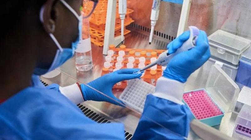 Earlier the National Institute for Communicable Diseases said the daily number of new confirmed cases in South Africa almost doubled to 8,561 infections in the last 24 hours. (Bloomberg) Earlier the National Institute for Communicable Diseases said the daily number of new confirmed cases in South Africa almost doubled to 8,561 infections in the last 24 hours. (Bloomberg)