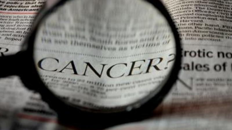 Cases documented over the years by experts across the world show that those who are overweight or obese have a greater risk of colorectal cancer. (Representational image) Cases documented over the years by experts across the world show that those who are overweight or obese have a greater risk of colorectal cancer. (Representational image)