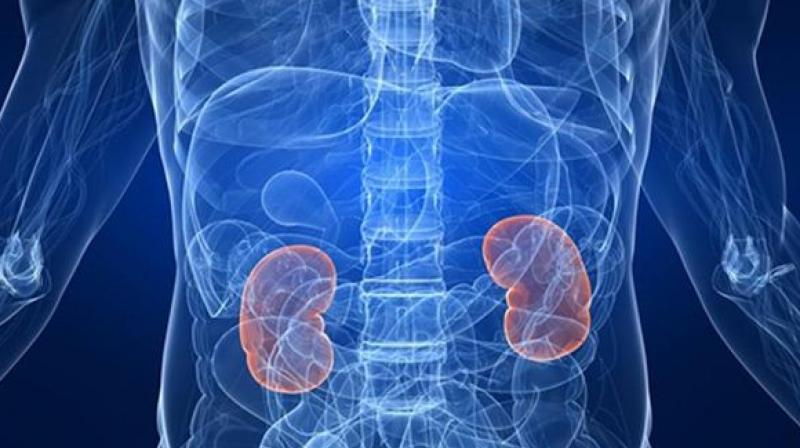 Afflicted with kidney failure for 20 years, Mr More, from Wadala, failed to retain his kidney functions after both his organs stopped working. (Representational image) Afflicted with kidney failure for 20 years, Mr More, from Wadala, failed to retain his kidney functions after both his organs stopped working. (Representational image)